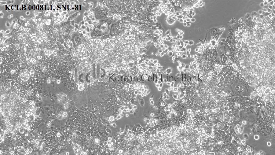 SNU-81
