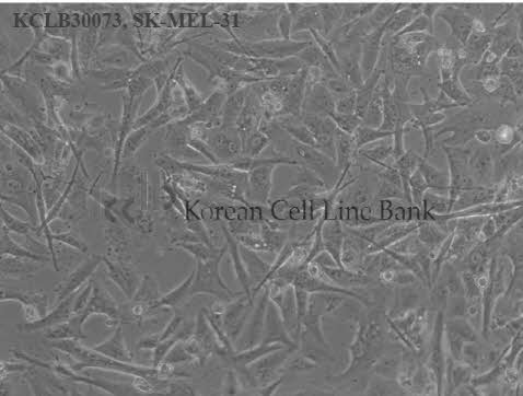 SK-MEL-31