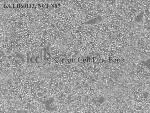 NCI-N87