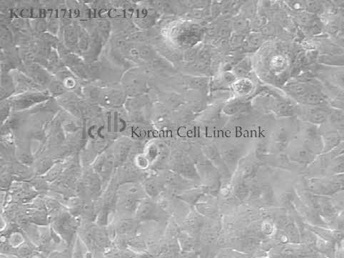 HCC-1719