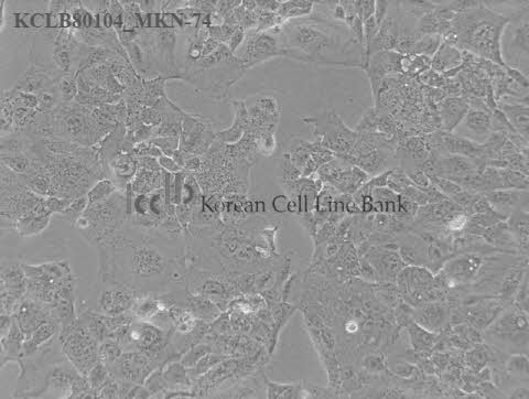 MKN-74