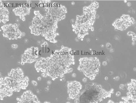 NCI-H1581
