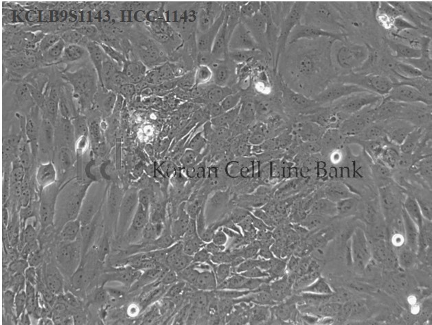 HCC-1143
